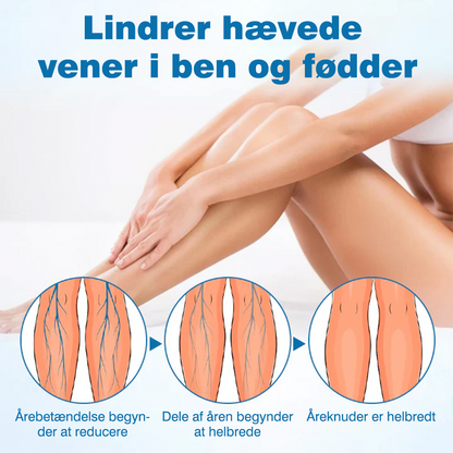 🔥Ourlyard® VeinGuard Urtespray – ✅ Klinisk dokumenteret til at fjerne åreknuder på kun 7 dage!